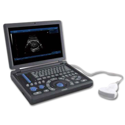 Ultrasonic Diagonstic System